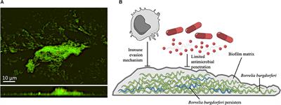 The Emerging Role of Microbial Biofilm in Lyme Neuroborreliosis